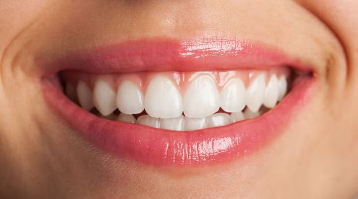Teeth Whitening Guide: Expert Insights and Helpful Facts