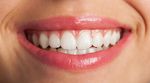 Teeth Whitening Guide: Expert Insights and Helpful Facts